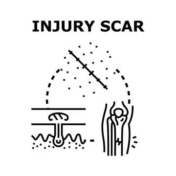 Injury scar healing process causing skin damage concept Stock Illustration