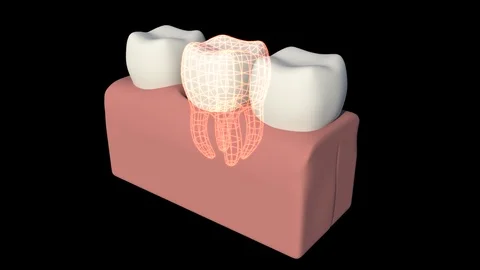 Inner Section Anatomy Of Tooth Stock Footage 112663732