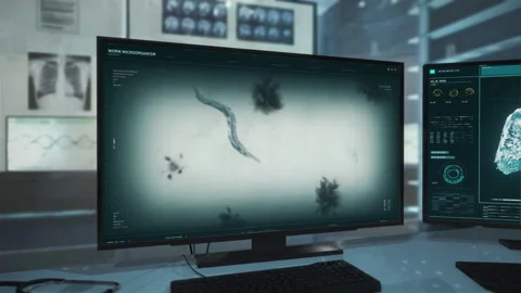 Innovative Medical Analysis Software Detects Parasitic Worm In Patients Organism Vidéo 245020895
