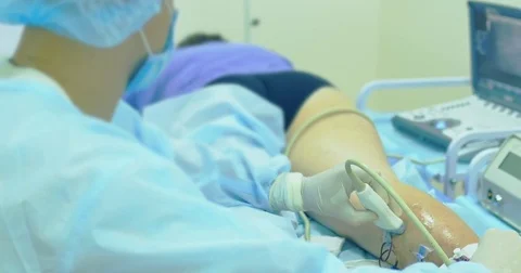Innovative method of varicose veins surgery, sclerotherapy procedure. Close-up 스톡 동영상 83037689