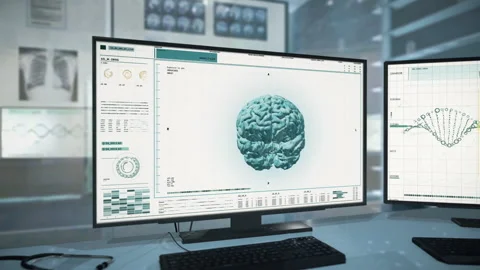 Innovative X-Ray Diagnostic Software For Medical Treatment Of Human Organism Stock Footage 159010881