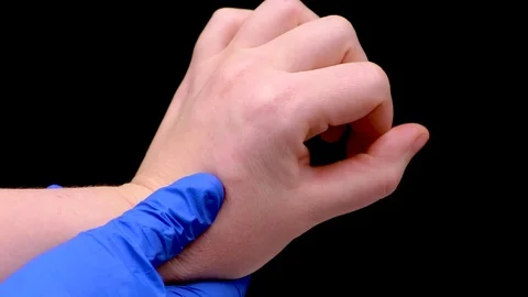 Insect bite close up. Doctor in blue medical glove inspect bite site Stock Footage 106581756