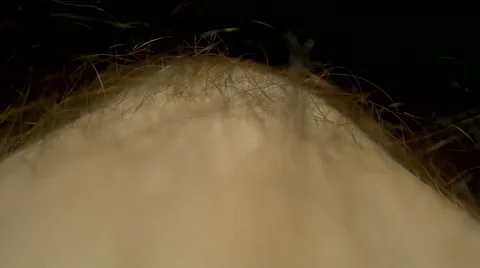 Insect crawling through the hair on the human leg. Macro Stock Footage 61552386