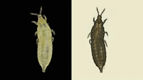 Insect larva Thysanoptera under a microscope Stock Footage 133491518