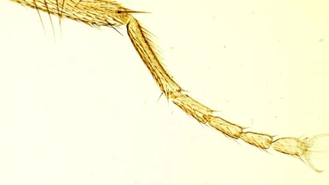 Insect leg microscope Video stock 91891500