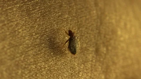 Insect macro 4k: Common bedbug parasite  on human skin in bed at night Video stock 80331088