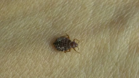 Insect macro 4k: Common bedbug parasite  on human skin in bed at night Video stock 80331127