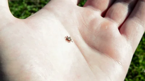 Insect parasite mite 動画素材 49195063