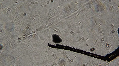 Insect is seen in an optical microscope Video stock 58815770