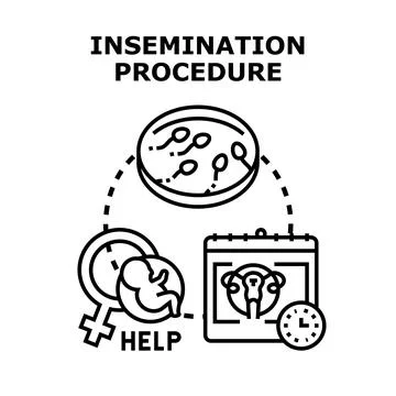 Insemination procedure vector concept assisting fertility treatment Stock Illustration