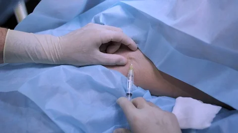 Inserting a needle under the skin of the armpit. Armpit injection Stock Footage 123284085