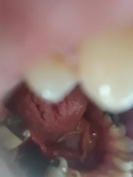 Inside Mouth Close-Up - Intimate View, Biological Detail, Human Interior Symbol Stock Photos