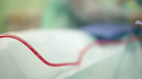 Inside surgery, blood is moving inside plastic tube during operation, closeup Stock-Footage 167004834