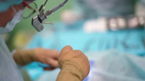 Inside surgery room during endoscopic operation, surgeon is working Video stock 167112183