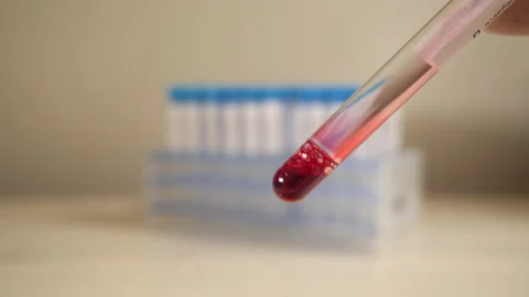 Inspecting blood sample in test tube, then placing it in rack. Stock Footage 143193138
