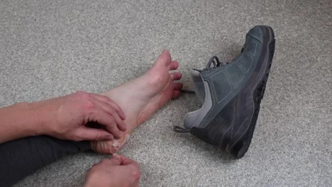 Inspecting large blisters and calluses on the heel by hiking boot Video stock 287131037