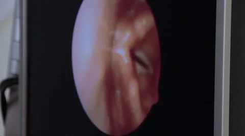 Inspection Inside The Throat Stock Footage 45859912