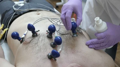 Install ECG suckers Video stock 103097832
