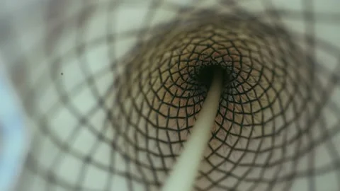 Installation of a self-expanding nitinol stent in the esophagus. Video stock 159660075