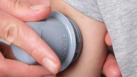 Installation of a sensor for glycemia control on the hand of a child with type 1 Stock Footage 252093674