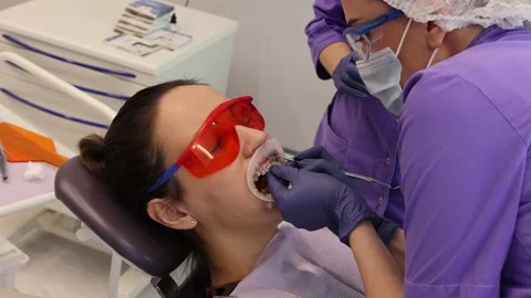 Installing braces at the orthodontist, dentistry, checking the doctor in gloves Stock Footage 156065886
