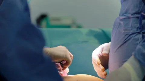 Installing laparoscopy camera surgery robot in surgical room in hospital with 動画素材 102186496