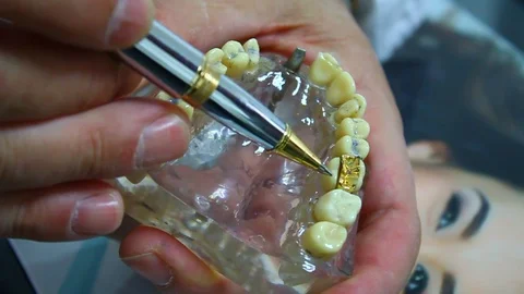  Instruction for dental prosthesis Stock Footage