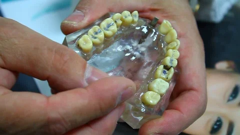 Instruction for dental prosthesis Stock Footage