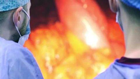 Instrument for laparoscopic surgery. Stockbeeldmateriaal 270547600