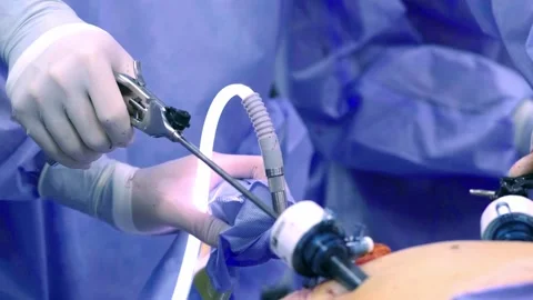 Instrument for laparoscopic surgery. Stockbeeldmateriaal 270549904