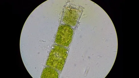 Intense bacterial activity surrounding green algae filament Stock-Footage 122108230