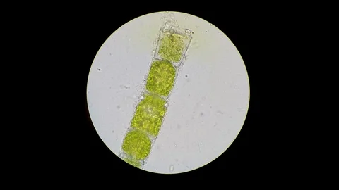 Intense bacterial activity surrounding green algae filament Video stock 122108247