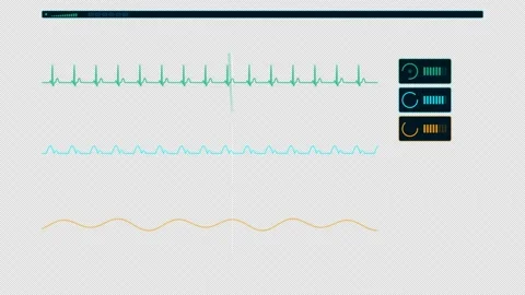 Intensive Care Multi Parameter Patient Vitals Monitor HUD with real time ECG wav Видео 346019466
