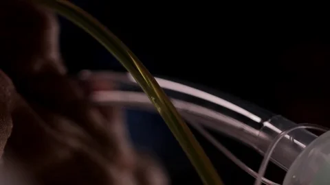 Intensive care unit Stock Footage 80809567