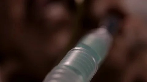 Intensive care unit man Stock Footage 80809564