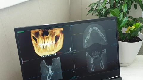 Interactive 3D Dental CBCT Volume Rendering and Multi-Planar Scan Layout. D.. Stock Footage 341286723