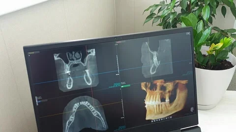 Interactive 3D Dental CBCT Volume Rendering and Multi-Planar Scan Layout. D.. Stock Footage 341286826