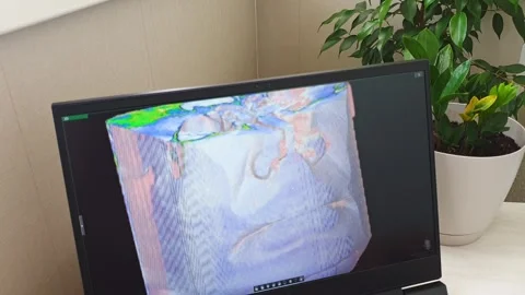 Interactive 3D Medical Scan Manipulation of Human Skull with Cursor. Dental Stock Footage 341284643
