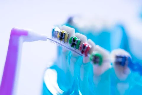 Interdental teeth brackets clean Stock Photos