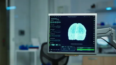 Interior of empty science laboratory for neurological treatment 스톡 동영상 148988340