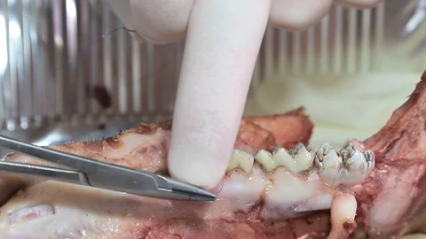 An Intern dentist learns to close up a pig's jaw model to sew up wounds with Video stock 122620174
