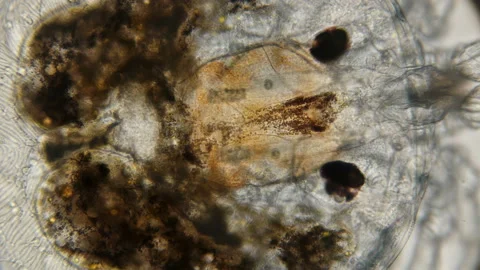 The internal organs of the water mite, under a microscope Stock Footage 91957254