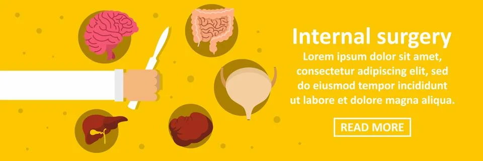 Internal surgery banner horizontal concept Illustrazione stock