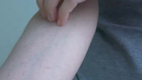 In the interval from the elbow to the hand, close-up shows small light pink Stock Footage 150628999
