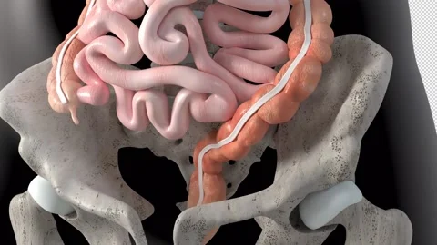 Intestinal Diverticula Overview Stock-Footage 235833563