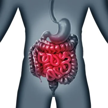 Intestinal Pain Stock Illustration