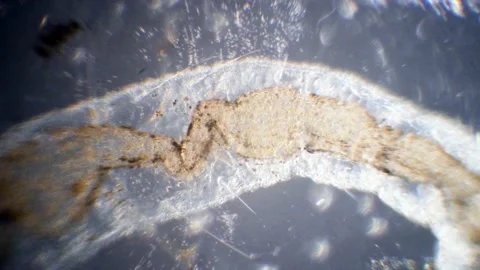 Intestine of nematode under the microscope, 150x magnification Stock Footage 152569205