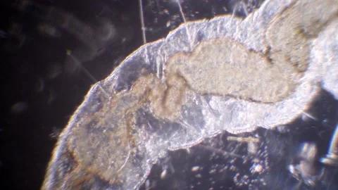 Intestine of nematode under the microscope, nematoda,darkfield microscope Stock Footage 232269008