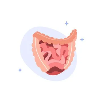 Intestines diseases. Enteritis, ulcerative colitis, Crohn's disease, polyp, c Stock Illustration