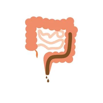 Intestines on a white background. Diarrhea. Vector illustration. Illustrazione stock
